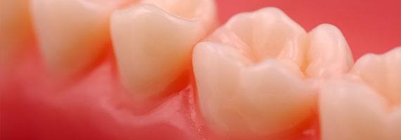 Learn more about Gum Grafting